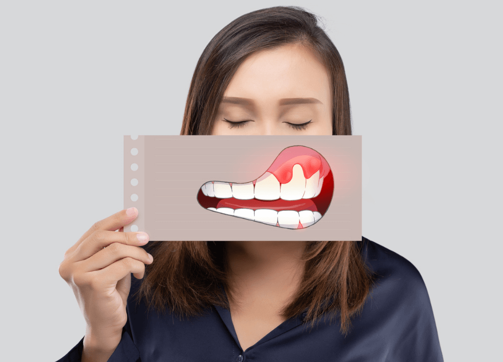 gum disease treatment near you