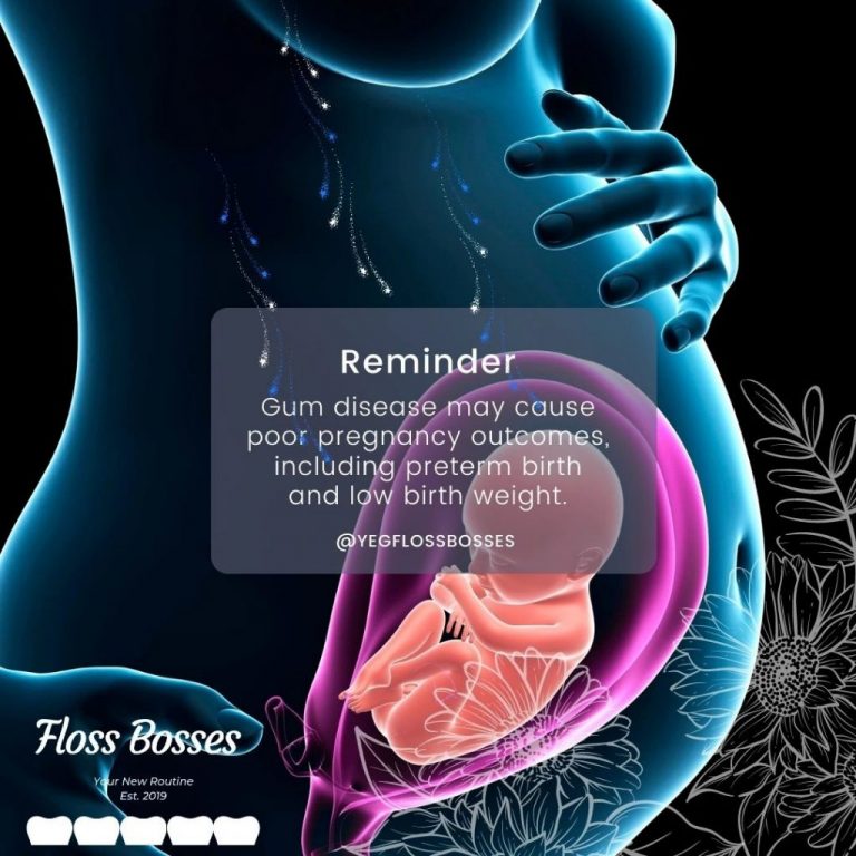 Pregnancy & Gum disease introduction Floss Bosses